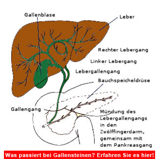 Gallenwege