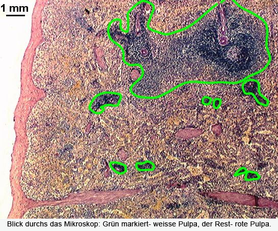 milz-histo